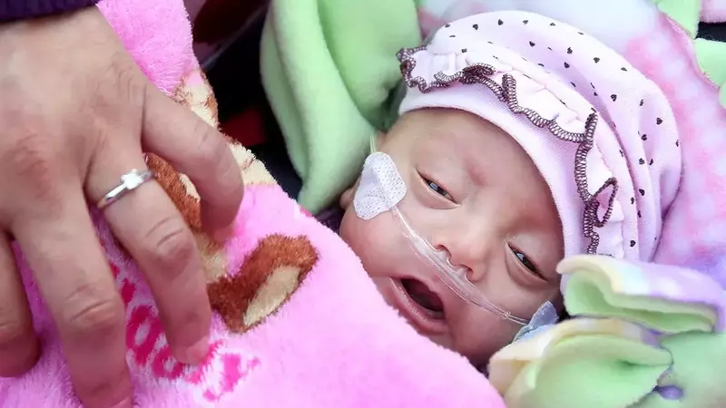 The Amazing Resilience of Premature Babies: Stories of Survival and Hope