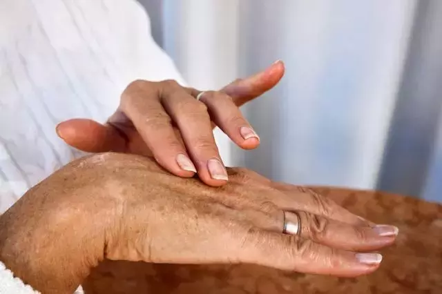 Reversing the Clock: A Dermatologist's Guide to Youthful Hands with Retinol